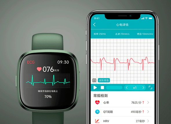 健康手表智能苹果版:2023智能手表新趋势：健康新赛道备受关注